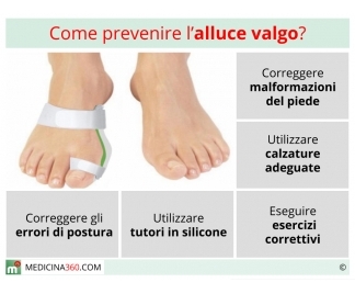 Alluce valgo prevenzione