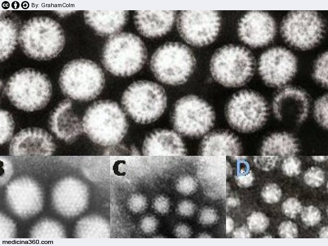 Gastroenterite virale