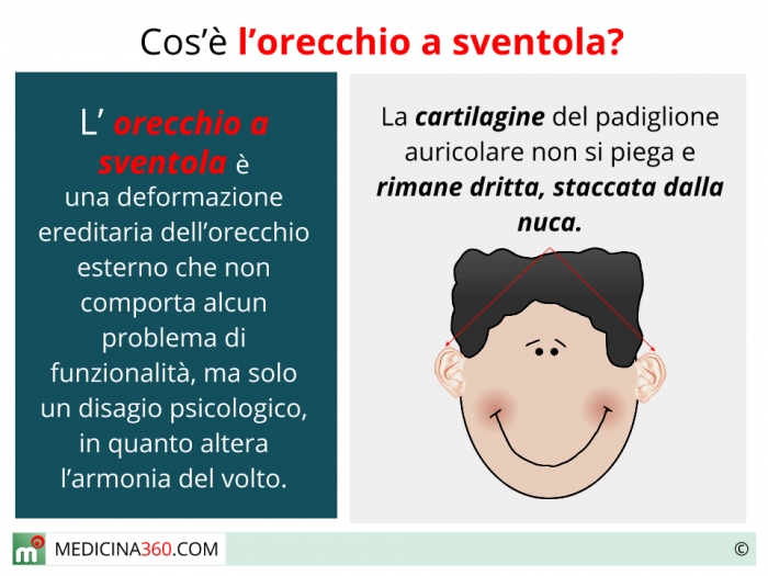 Orecchie a sventola: rimedi naturali per adulti e bimbi senza intervento