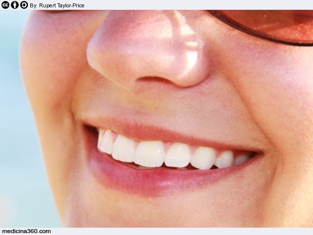 Sbiancamento dei denti: fai da te o dal dentista; pro e contro, costo e foto