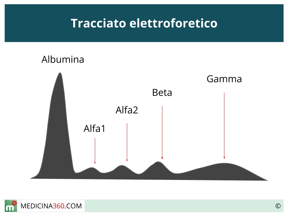 Elettroforesi proteica: alfa, beta e gamma