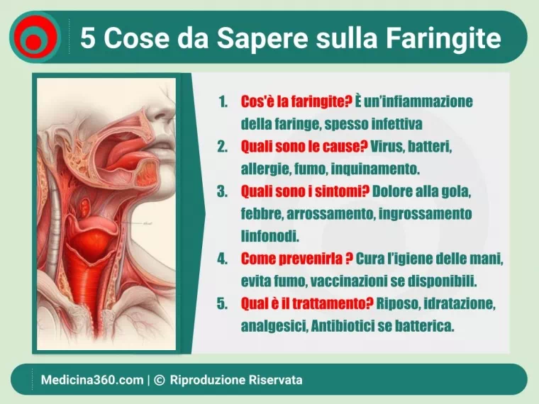 Faringite: Guida Completa - Cause, Sintomi e Trattamenti