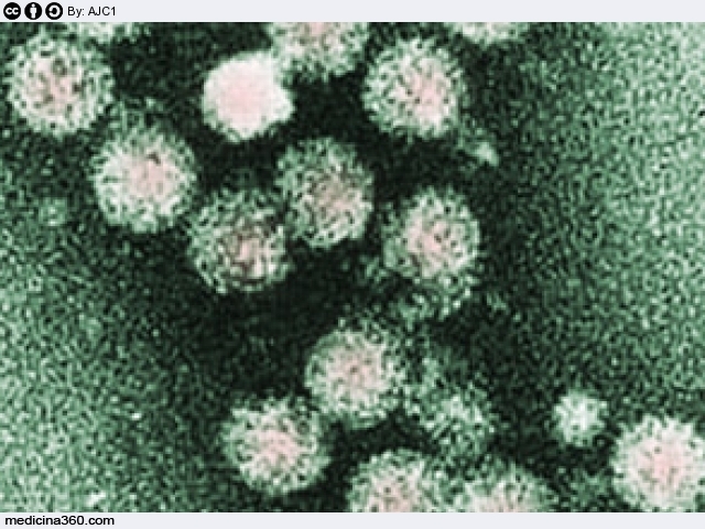 Interferone per epatite c: terapia ed effetti collaterali