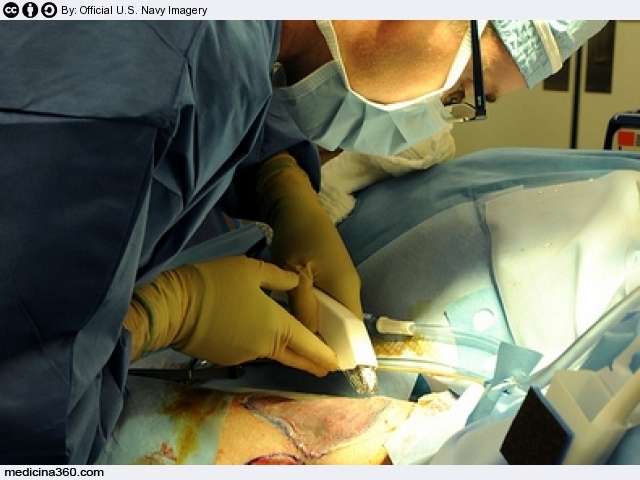 Interventi chirurgia plastica