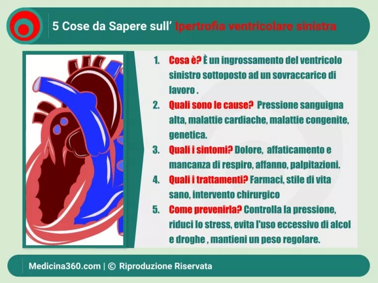 Ipertrofia ventricolare sinistra: Una guida completa per capire e gestire la condizione