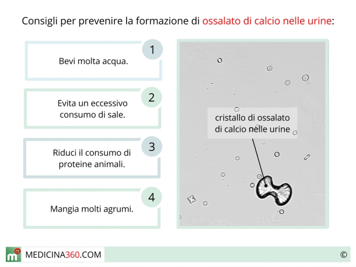 Кристаллы кальция в моче у мужчин. Оксалаты в моче. Соли оксалаты в моче. Оксалаты кальция в моче. Соли оксалата кальция в моче.