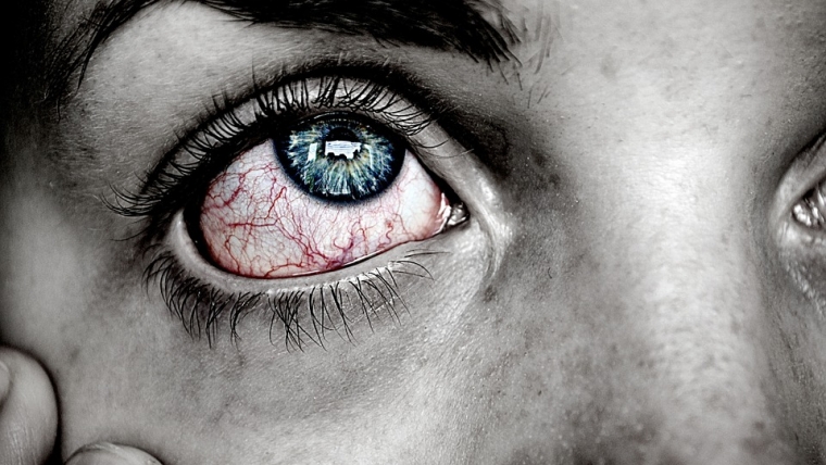 Rottura capillare dell’occhio: cause, sintomi e cure