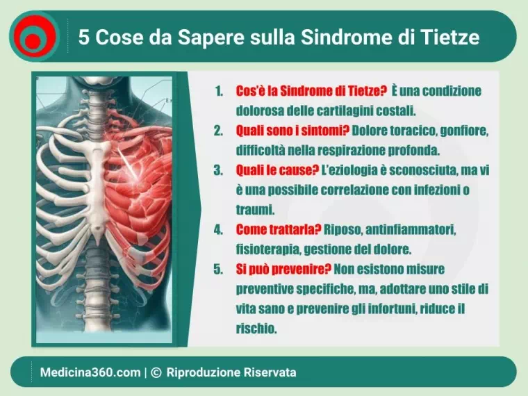 Sindrome di Tietze: sintomi, cause, diagnosi, terapia e cure naturali per la costocondrite