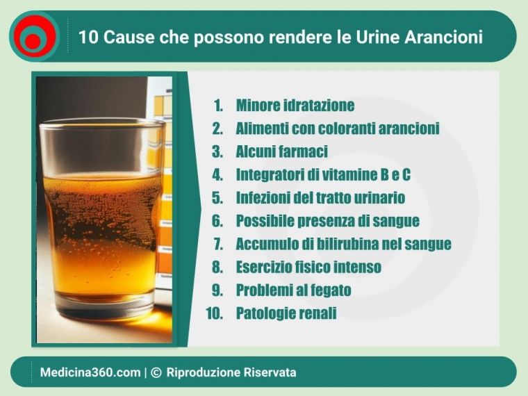 Urine Arancioni: Cause, Diagnosi e Trattamenti Dettagliati