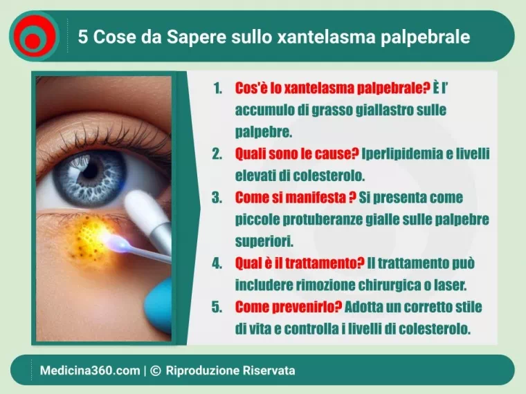 Guida Completa allo Xantelasma Palpebrale: Cosa Devi Sapere